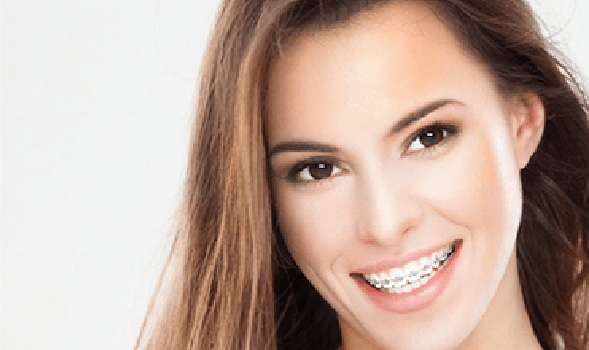 braces